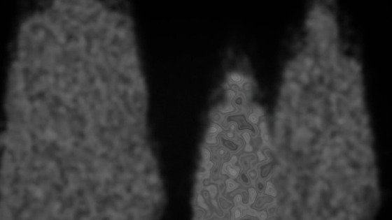 00860