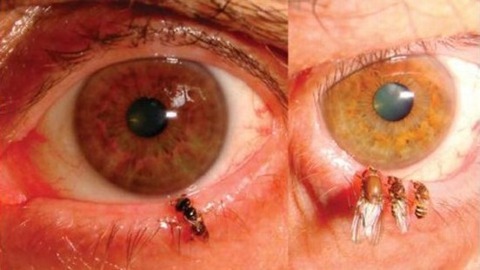 eyebee-thumb-550xauto-90583