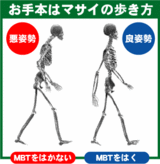 MBT ������ȥ�
