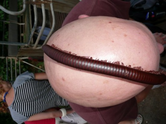 millipede-on-bald-guyxs-head