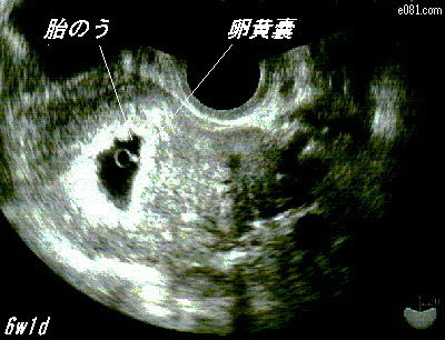 pm6w1d-1