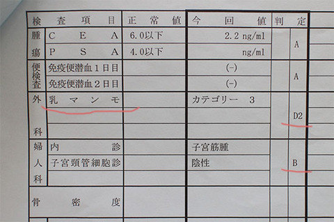 乳がん 婦人科検診 再検査