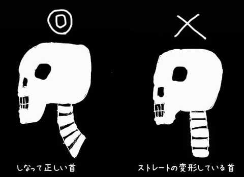 ストレートネック 解消方法 NHK ためしてガッテン 肩こり消法