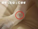 腫瘍