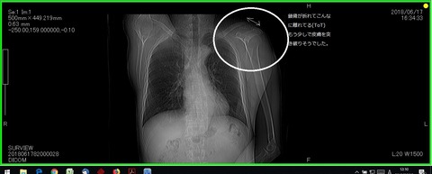 キャプチャ20180617