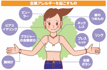 金属アレルギー