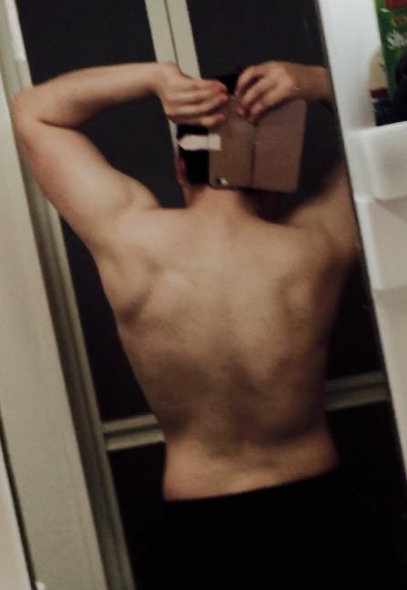 18