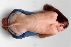 32