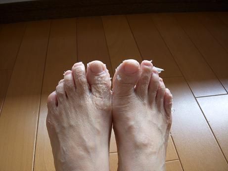 足