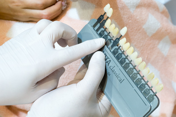 きれいな歯クリニックさくら ホワイトニング 1-41