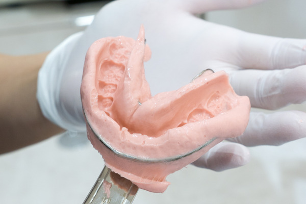 きれいな歯クリニックさくら ホワイトニング 1-16