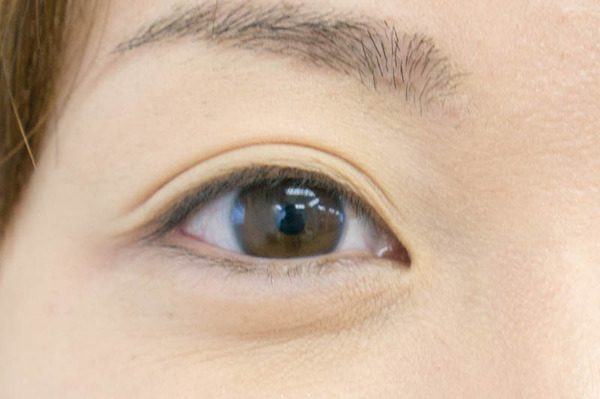 ミニョン5-1605061