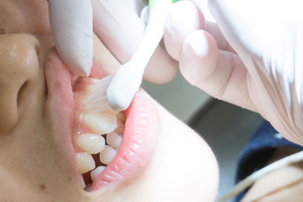 きれいな歯さくら ホワイトニング 2-12