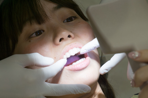 きれいな歯さくら ホワイトニング 2-7