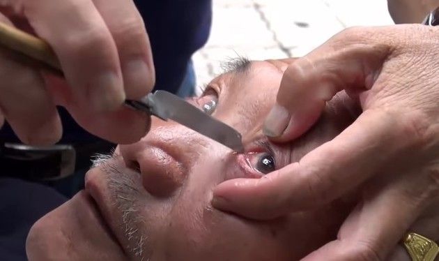 カミソリで目を掃除する中国の美容師