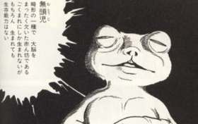 無頭児、無脳症の画像 (3)