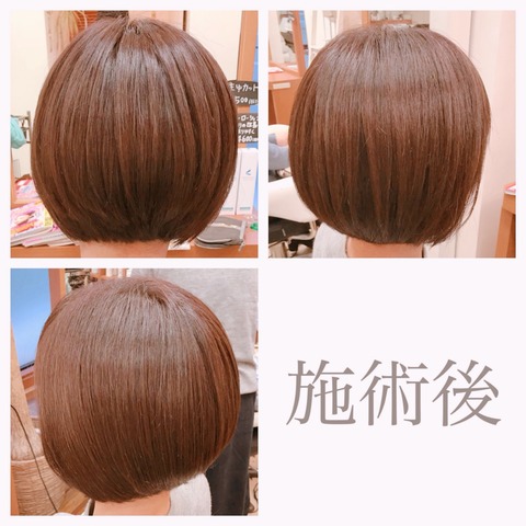 1517008105616