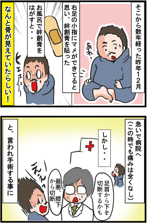 【血糖値500超え】新宿2丁目人気ママ兼タレントが2型糖尿病で小指切断に…2