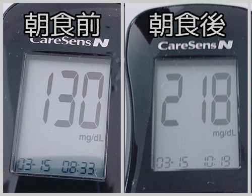 朝食前後血糖値