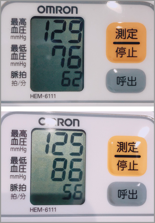 血圧