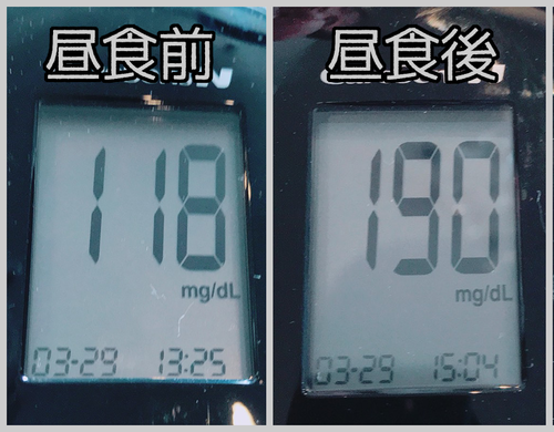 昼食前後血糖値