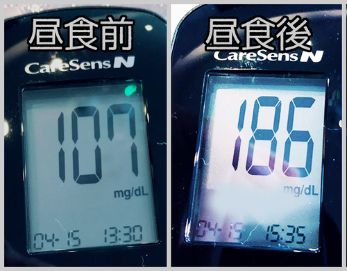 昼食前後血糖値
