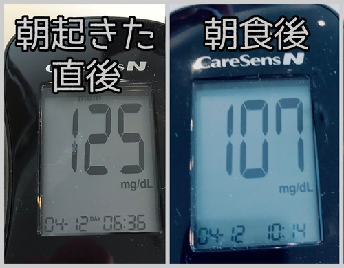 朝食前後血糖値