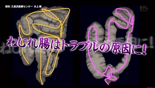凹凸ちゃんねる