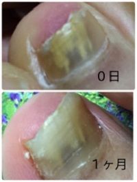 Evernote Camera Roll 20160920 202713