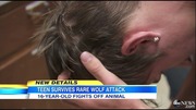 minnesota_wolf_attack_ABCNews10