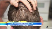 minnesota_wolf_attack_ABCNews14