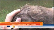 minnesota_wolf_attack_NBCNews02