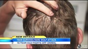 minnesota_wolf_attack_ABCNews13