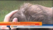 minnesota_wolf_attack_NBCNews03