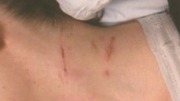 wolf attacked 2