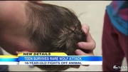 minnesota_wolf_attack_ABCNews09