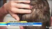 minnesota_wolf_attack_ABCNews12