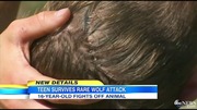 minnesota_wolf_attack_ABCNews01