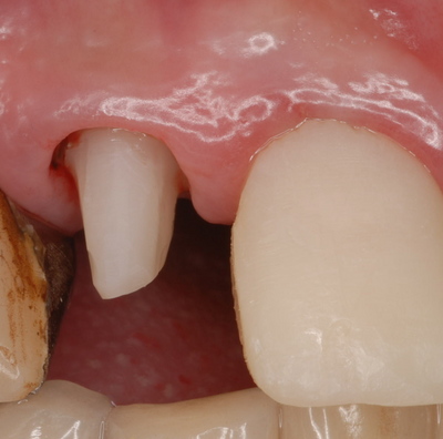 13 18-23-23 16-52-55