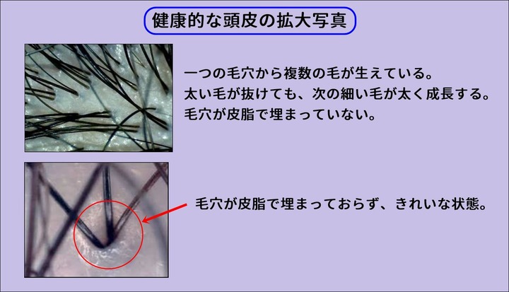 健康的な頭皮の拡大写真