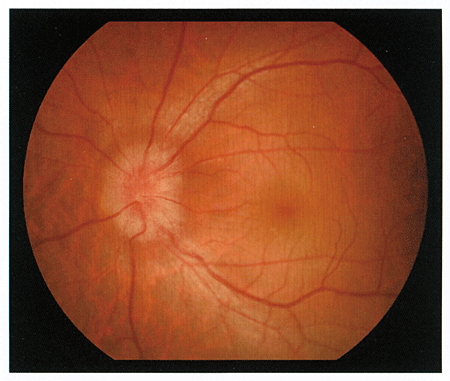 106D11