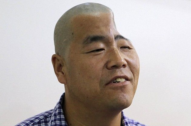 中国 落下事故で頭が凹んだ男性 3dプリンターで復元へ 画像あり まとめサイトビルダーを使ってみた