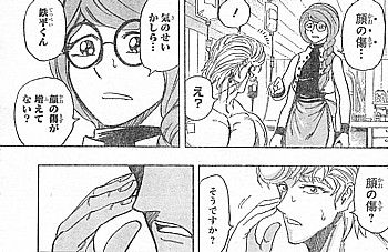 t顔の傷3