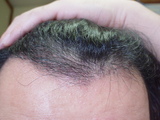2006112108