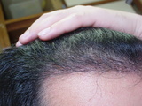 2006112106