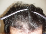 2007021903