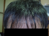2006112101