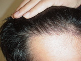 2007010704