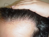 2007010705
