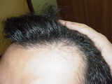 2007061611